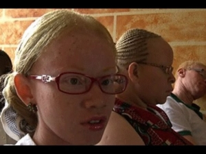 C&ocirc;te d'Ivoire-Emploi : 300 handicap&eacute;s dont des albinos int&eacute;gr&eacute;s &agrave; la fonction publique avant fin juin 2015